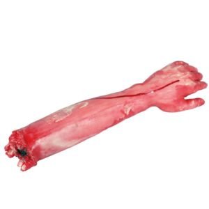 Braço mutilado
